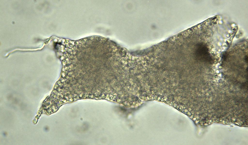 Physarum decipiniens (??)